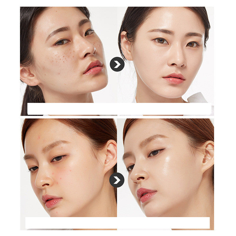 HOOR Korean Acne Skin Care
