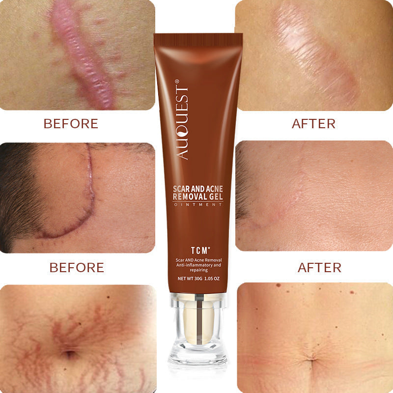 HOOR Repairing Scar Skin Care