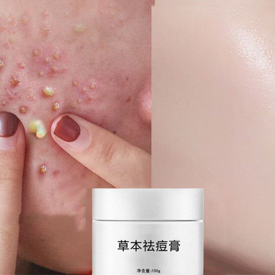 HOOR Korean Acne Skin Care